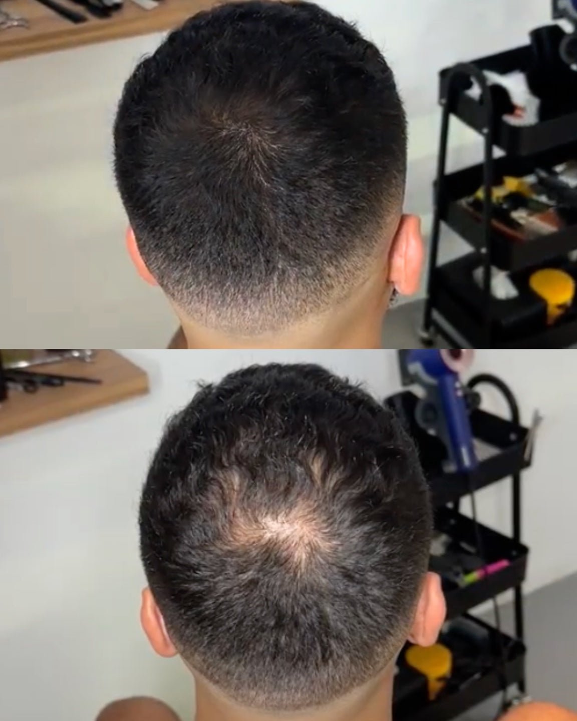 HairPowder™ | Direct een vollere haarlijn