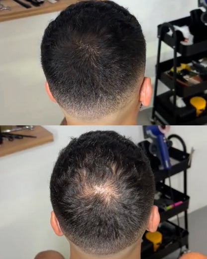 HairPowder™ | Direct een vollere haarlijn