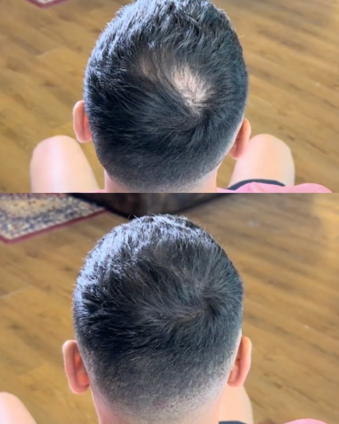 HairPowder™ | Direct een vollere haarlijn