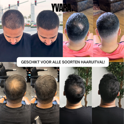 HairPowder™ | Direct een vollere haarlijn