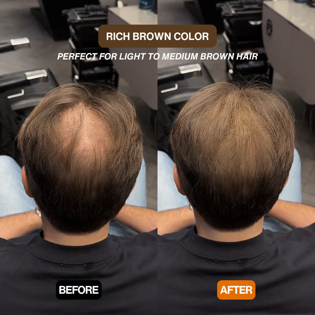 HairPowder™ | Direct een vollere haarlijn
