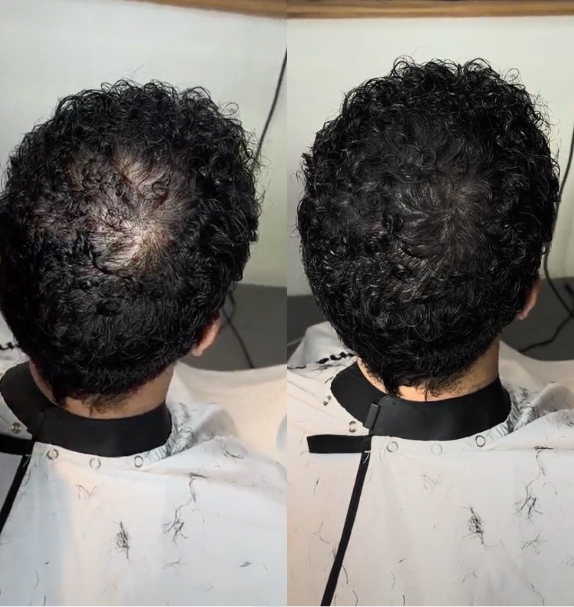 HairPowder™ | Direct een vollere haarlijn